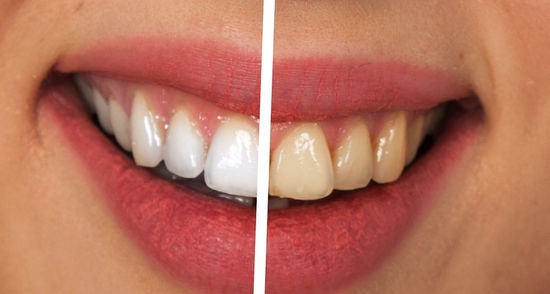 5 ways to keep your gums healthy