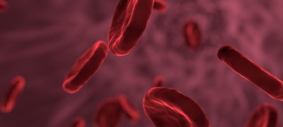 Capire l'aterosclerosi arteriosa