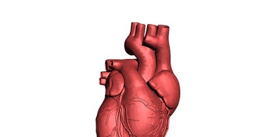 Inzicht in arteriële atherosclerose