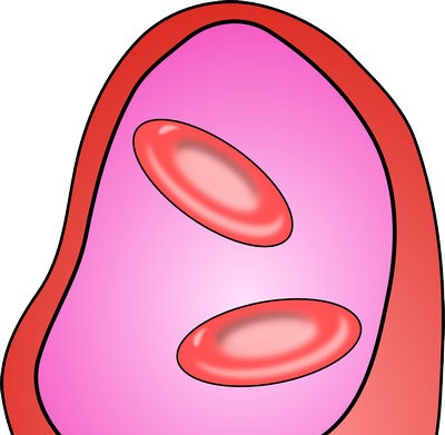 Prevention of atherosclerosis should be started in childhood