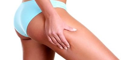 Điều trị cellulite và chống cellulite